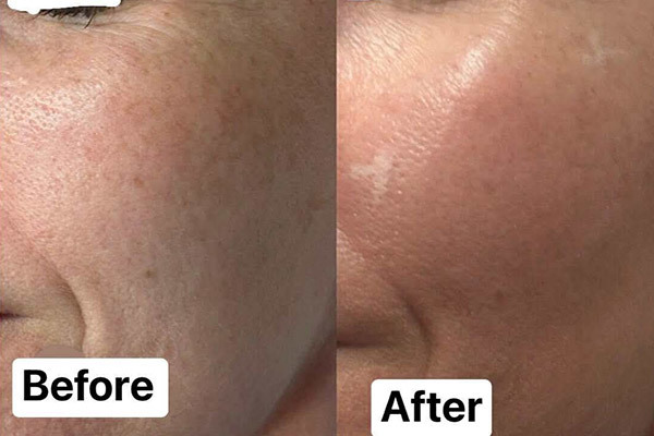 リバイタライジング・ビューティー_Revitalizingbeauty