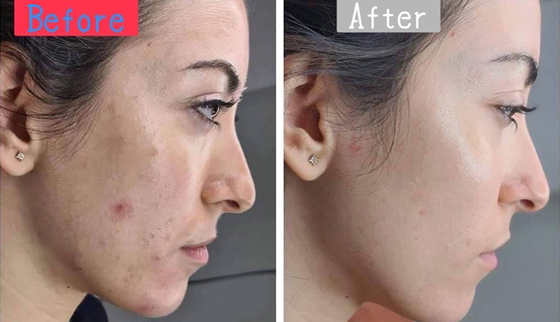 アンチエイジング_Anti-aging